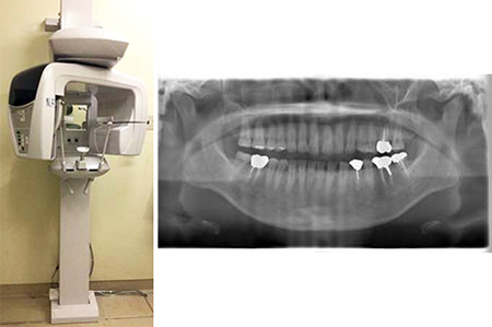 パノラマ撮影（撮影室２）、上下顎及び全歯の断層撮影