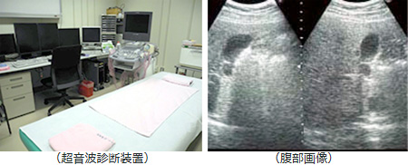 超音波診断装置　腹部画像