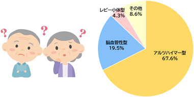 認知症の原因として、最も割合が多い「アルツハイマー病」