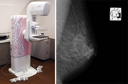 撮影室16　マンモグラフィ