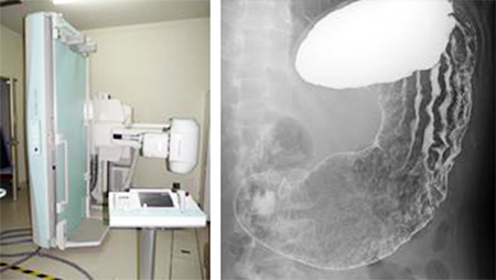 上部消化管Ｘ線検査