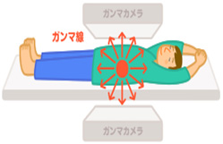 核医学検査のしくみは？