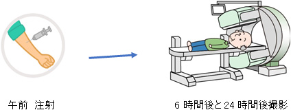 ソマトスタチンレセプターシンチ（オクトレオスキャン）