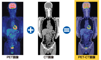 PET画像、CT画像、PET-CT画像比較