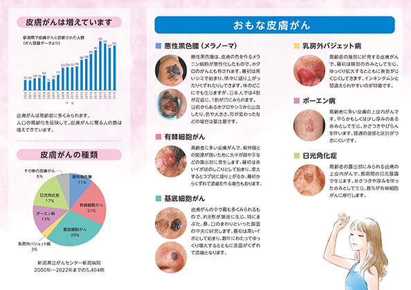 リーフレット：皮膚がん　皮膚にもがんができるの？